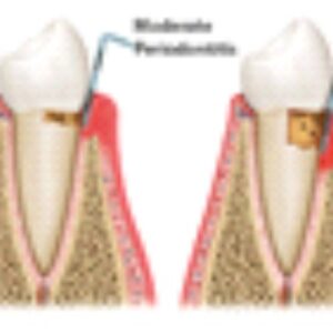 Alternative view of Dental Pharma Products
