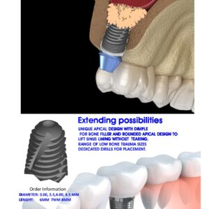 sinus & VT implant leaflet