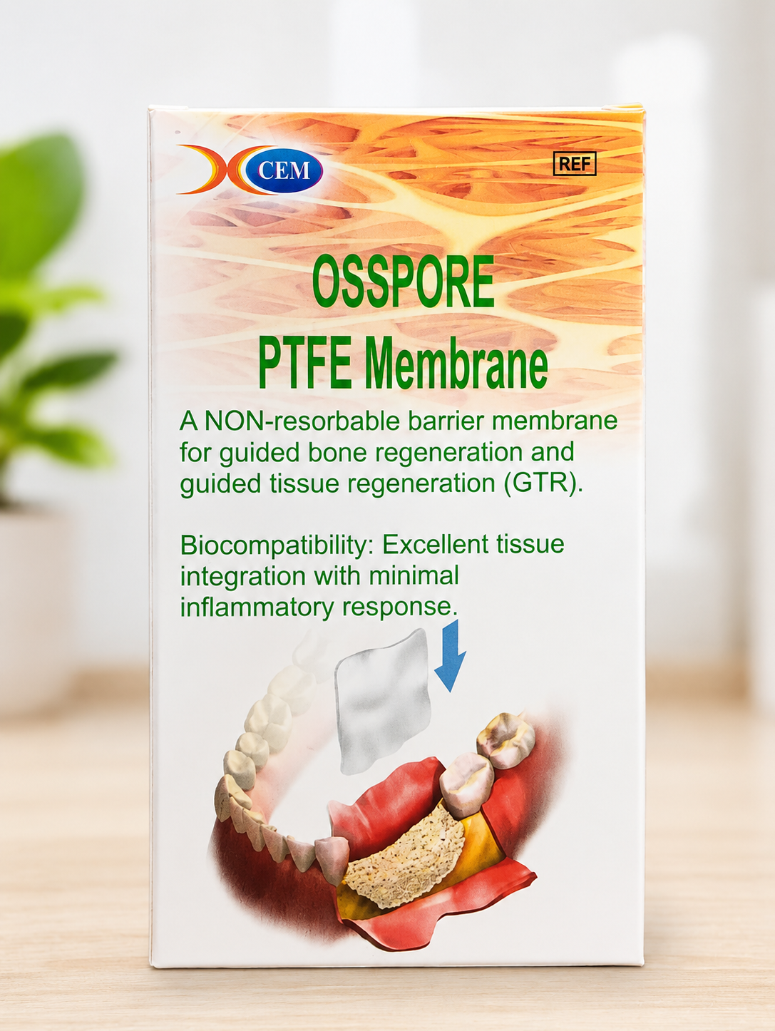 OSSPORE PTFE Membrane