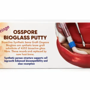 OSSPORE Bioglass Putty Bioactive Synthetic Bone Graft Syringe