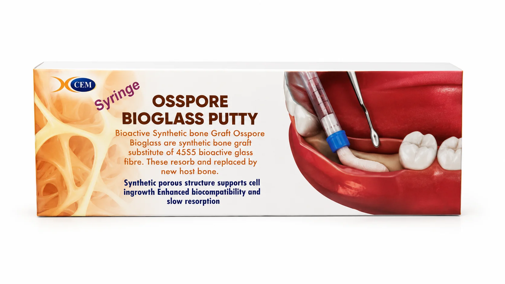 OSSPORE Bioglass Putty Bioactive Synthetic Bone Graft Syringe
